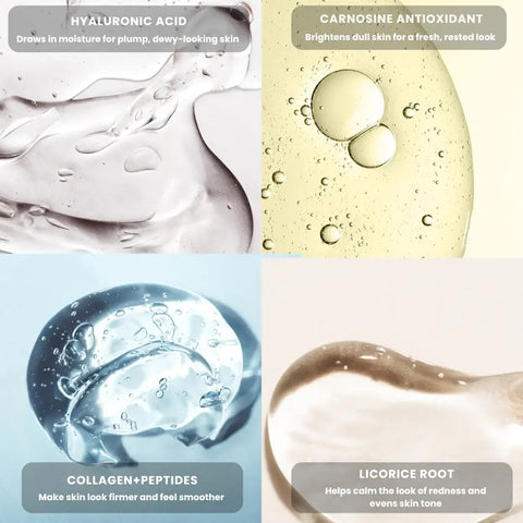 SoothingSkin Micro infuussysteem
