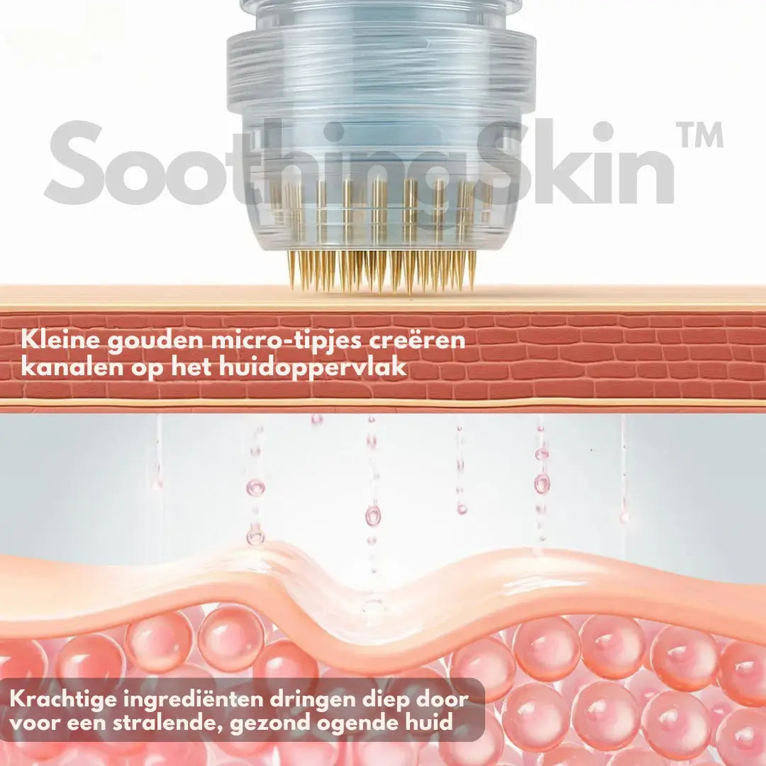 SoothingSkin Micro Infuussysteem
