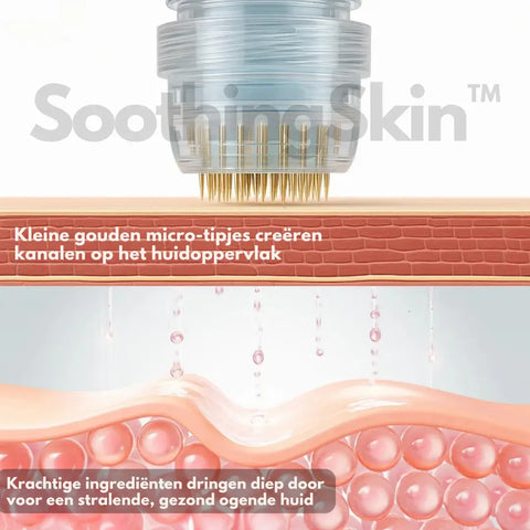 SoothingSkin Micro infuussysteem