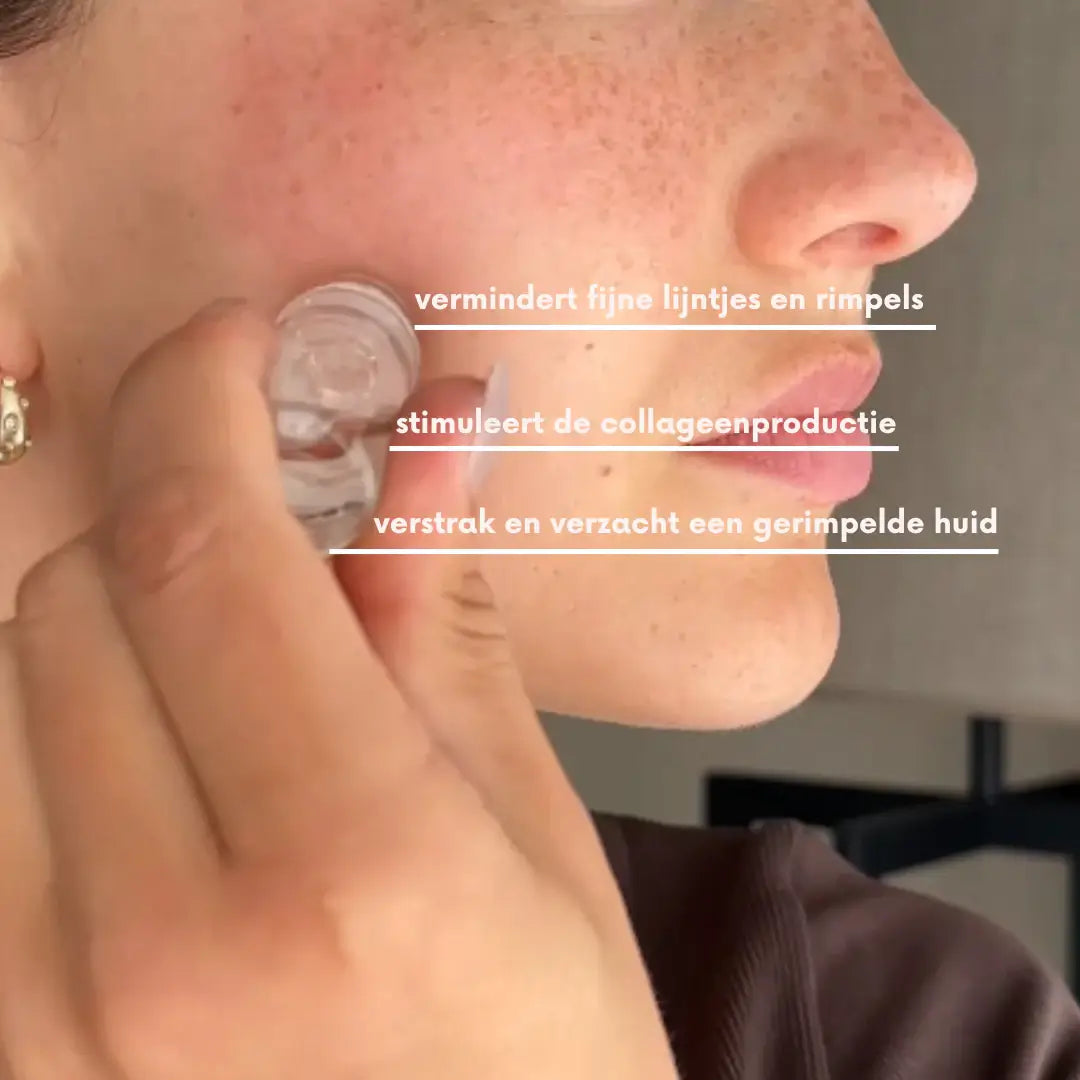 SoothingSkin Micro Infuussysteem