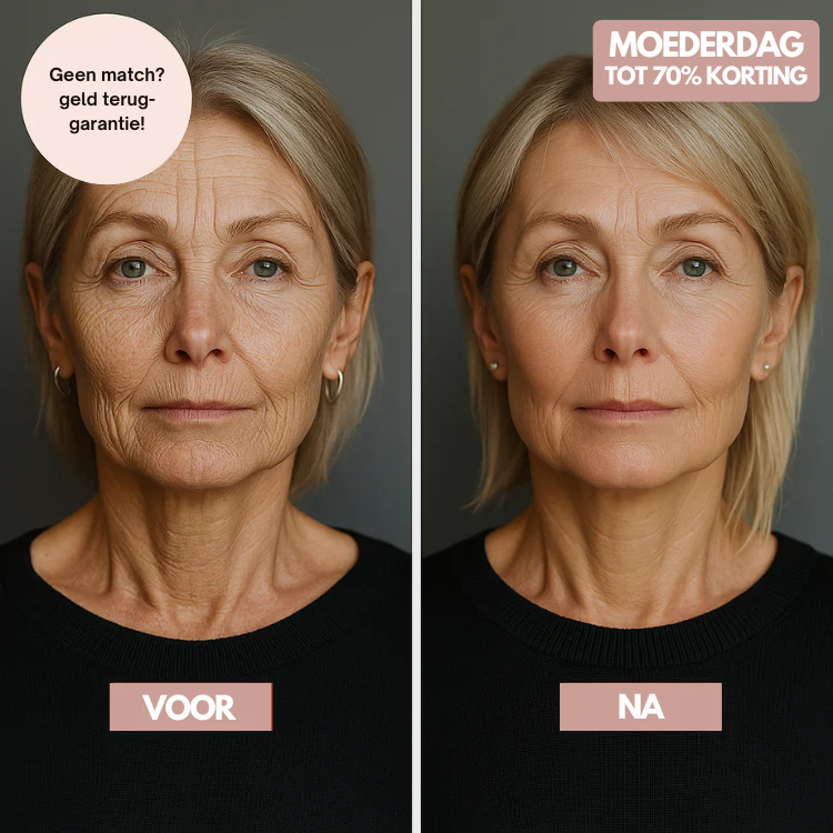 SoothingSkin Micro Infuussysteem- Thuis Huidverjonging - Rimpels Weg, Collageen Boost, Directe Glow, Huidverbetering, Thuis Spa