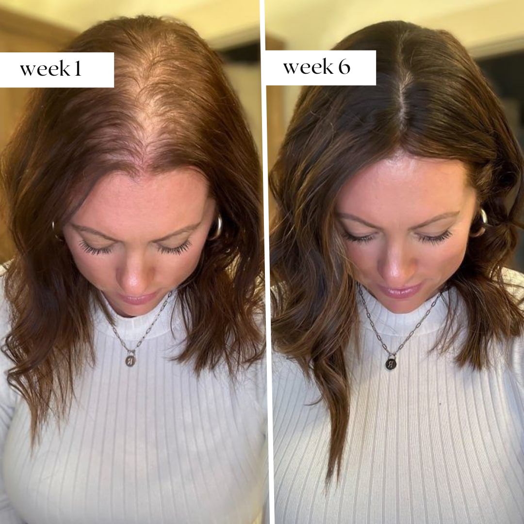 SoothingSkin Haargroeisysteem