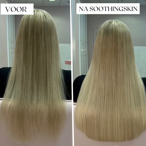 SoothingSkin Haargroeisysteem